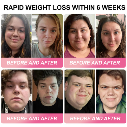 New Watermelon + Strawberry Flavor | Piguiay® Weight Loss Drops — 60% OFF Today Clinically designed for obesity, diabetes, heart health, sleep apnea & more — powered by GLP-1 peptides. 💦