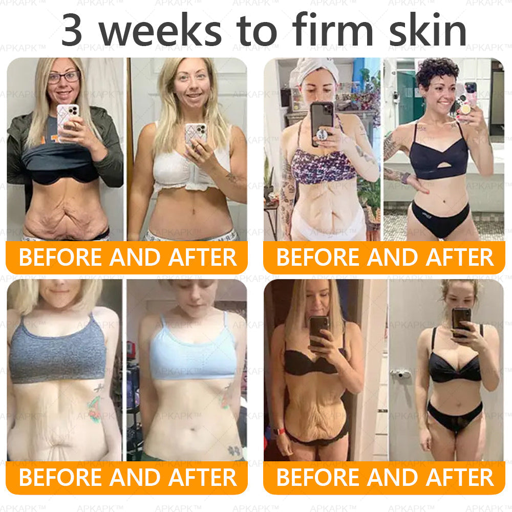 𝐌𝐚𝐝𝐞 𝐚𝐧𝐝 𝐒𝐡𝐢𝐩𝐩𝐞𝐝 𝐟𝐫𝐨𝐦 𝐭𝐡𝐞 𝐔𝐒 𝐀𝐖𝐙𝐋𝐎𝐕𝐄® 𝐁𝐞𝐞 𝐯𝐞𝐧𝐨𝐦 𝐂𝐨𝐦𝐩𝐫𝐞𝐡𝐞𝐧𝐬𝐢𝐯𝐞 𝐂𝐫𝐞𝐚𝐦  𝐋𝐀𝐒𝐓 𝐃𝐀𝐘 𝟖𝟎% 𝐎𝐅𝐅💦🌵