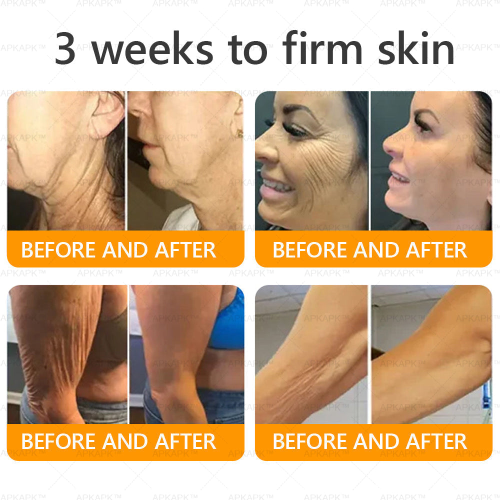 𝐌𝐚𝐝𝐞 𝐚𝐧𝐝 𝐒𝐡𝐢𝐩𝐩𝐞𝐝 𝐟𝐫𝐨𝐦 𝐭𝐡𝐞 𝐔𝐒 𝐀𝐖𝐙𝐋𝐎𝐕𝐄® 𝐁𝐞𝐞 𝐯𝐞𝐧𝐨𝐦 𝐂𝐨𝐦𝐩𝐫𝐞𝐡𝐞𝐧𝐬𝐢𝐯𝐞 𝐂𝐫𝐞𝐚𝐦  𝐋𝐀𝐒𝐓 𝐃𝐀𝐘 𝟖𝟎% 𝐎𝐅𝐅💦🌵