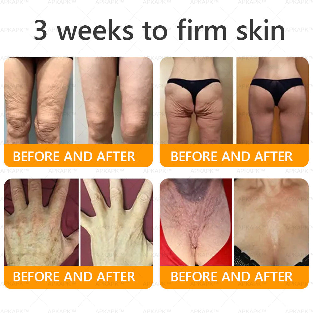 𝐌𝐚𝐝𝐞 𝐚𝐧𝐝 𝐒𝐡𝐢𝐩𝐩𝐞𝐝 𝐟𝐫𝐨𝐦 𝐭𝐡𝐞 𝐔𝐒 𝐀𝐖𝐙𝐋𝐎𝐕𝐄® 𝐁𝐞𝐞 𝐯𝐞𝐧𝐨𝐦 𝐂𝐨𝐦𝐩𝐫𝐞𝐡𝐞𝐧𝐬𝐢𝐯𝐞 𝐂𝐫𝐞𝐚𝐦  𝐋𝐀𝐒𝐓 𝐃𝐀𝐘 𝟖𝟎% 𝐎𝐅𝐅💦🌵