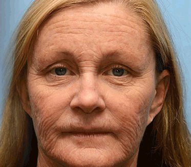 Made and shipped from the USA👩‍⚕️---Awzlove™ Luxurious Retinol &  Matrixyl 3000 Firming Wrinkle Removal Cream👩‍⚕️-Last Day Promotion 70% OFF👩‍⚕️